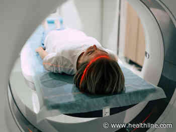 Dawson's Fingers: In Multiple Sclerosis and Other Brain Disorders - Healthline