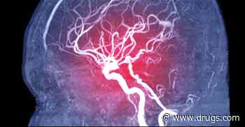 Genotype Tied to Endovascular Therapy Outcomes in LVO Stroke