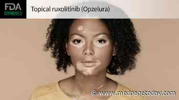 Topical JAK Inhibitor OK'd for Repigmentation of Vitiligo