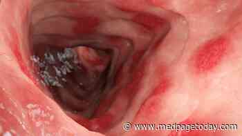 TNF Inhibitors, Thiopurines May Help Reduce Recurrent Acute Arterial Events