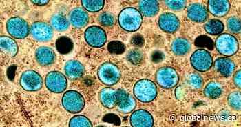 Public Health Ontario reports 230 monkeypox cases, up from 156 in last update
