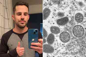 'Complete hell': Texas man describes monkeypox battle - New York Post