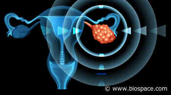 VBL Becomes Latest Casualty in Heated Battle to Solve Ovarian Cancer - BioSpace