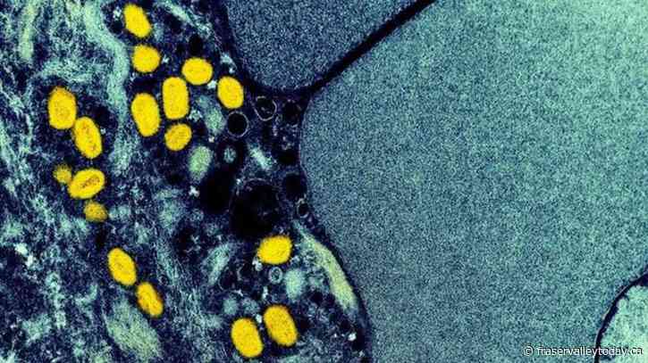 Feds announce $1 million fund to reach communities affected by monkeypox