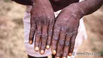 WHO again considers declaring monkeypox a global emergency - Belleville News-Democrat