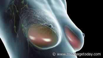 Breast Implant-Related Leukemia More Common Than Reported