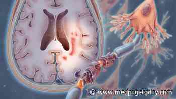 Off-Label Drug Lowers Relapses in Multiple Sclerosis