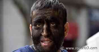 La historia de Chuy, el "hombre lobo" mexicano - Rosario3.com