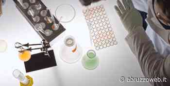 COVID: IN ABRUZZO INTENSIVE AL 6 PER CENTO, - 10 PER CENTO CONTAGI IN 7 GIORNI | Ultime notizie di cronaca Abruzzo - Abruzzoweb.it