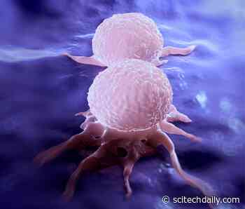 Encouraging Tumor Growth: How Breast Cancer Causes Diabetes