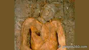 Genome of E.Coli Bacterium Reconstructed Using Gallstone From 600-Year-Old Mummy