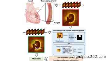This New AI-Based Technique Can Detect Heart Conditions, May Help Avert Heart Attacks
