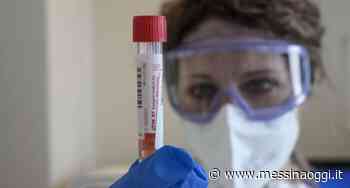 Covid: oltre 5mila contagi, Messina a quota 1122 - Messina Oggi