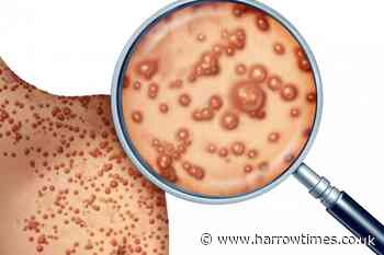 Monkeypox emergency declaration 'recognises need to stop global spread' - Harrow Times