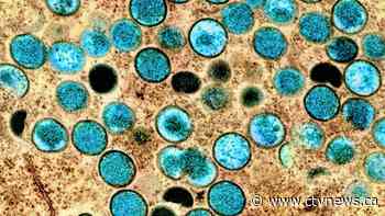 WHO declares monkeypox a global emergency; Canada confirms 681 cases