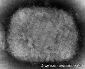 UN health agency chief declares monkeypox a global emergency - Nanaimo Bulletin