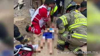 Salvan la vida de menor electrocutado en Hermosillo; tocó un cable al salir de alberca - TRIBUNA