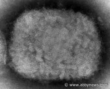 UN health agency chief declares monkeypox a global emergency - Abbotsford News