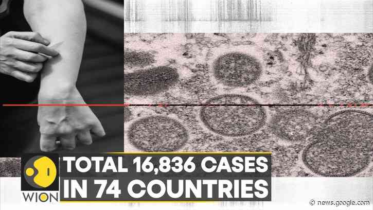 WHO declares Monkeypox outbreak a global health emergency | World Latest English News | WION - WION