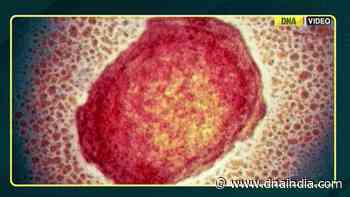 Monkeypox outbreak: Govt holds high-level meet on monkeypox | WHO Declared Global Health Emergency - DNA India