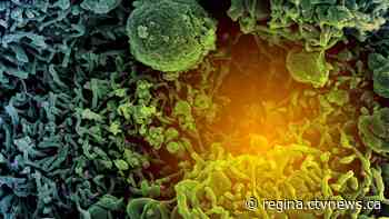 BA.5, BA.4 subvariants on the rise in Regina - CTV News Regina