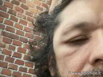 Ermal Meta preoccupa i fan: "Mi si gonfiano parti del viso e della testa"