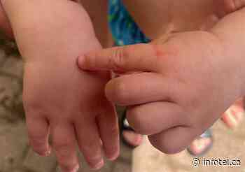 First Kamloops, now Vernon dealing with hand, foot and mouth disease outbreak | iNFOnews | Thompson-Okanagan's News Source - iNFOnews