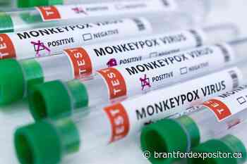 Only one case of monkeypox in Brantford-Brant so far - Brantford Expositor