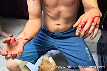 B.C. man injured protecting dog from backyard bobcat attack - Maple Ridge News