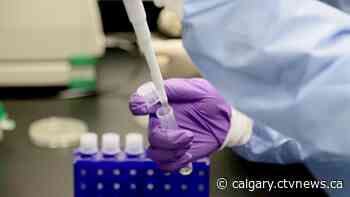 Wastewater analysis suggests COVID-19 spiking in Calgary | CTV News - CTV News Calgary