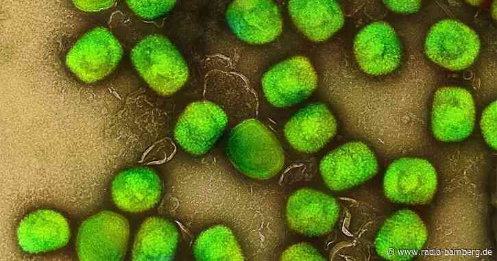 Brandbrief wegen Affenpocken – EU als Epizentrum