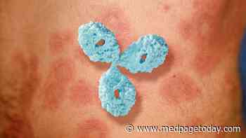 BDCA2-Targeting Antibody May Be Effective for Cutaneous Lupus