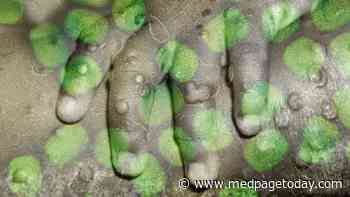 How Worrisome Are the Cases of Monkeypox in Kids?
