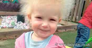 Tot with crazy Boris Johnson barnet has rare 'uncontrollable hair syndrome' - Daily Star
