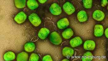 Gesundheit - Brandbrief wegen Affenpocken - EU als Epizentrum - Neue Presse Coburg