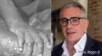 Vaiolo delle scimmie, Fabrizio Pregliasco: «Rischio endemizzazione, ma la vaccinazione di massa per ora non se - leggo.it