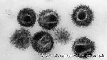Weiterer Patient offenbar von HIV geheilt