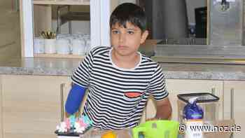 Zehnjähriger im Marien-Hospital: Nach Stromschlag: Was von Abdullahs Arm ist in Papenburg noch zu retten? - NOZ