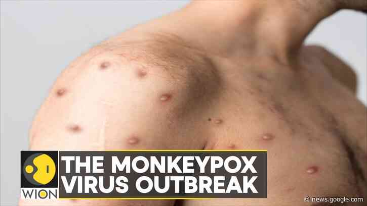 WION Fineprint: All that you need to know about Monkeypox | Latest English News - WION