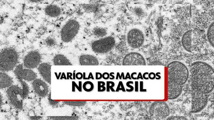 Itaperuna, RJ, confirma primeiro caso de varíola dos macacos - Globo