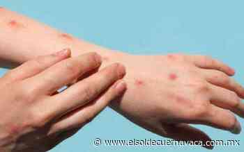 Cuernavaca refuerza protocolos de sanidad frente a viruela del mono - El Sol de Cuernavaca