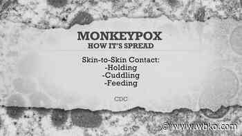 How is The Medical Center preparing for a possible surge in cases of monkeypox? - WBKO