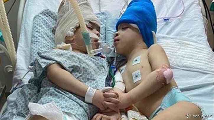 VR Technology Used To Help Separate Conjoined Twins
