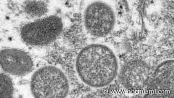 Miami Beach Commissioner Rings Alarm as Monkeypox Cases on the Rise