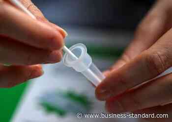 Coronavirus infection may accelerate brain ageing, shows new study - Business Standard
