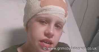 Dad 'disgusted' after Grimsby doctors miss fluid on brain that 'could have killed' son, 9 - Grimsby Live