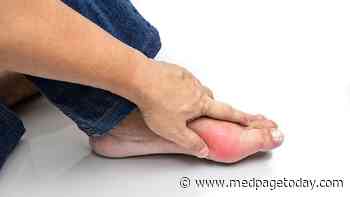 Gout Flare? Watch Out for Cardiovascular Events
