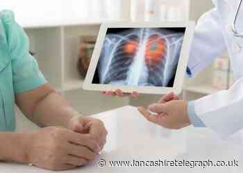 Radiologist urges people of Blackburn to accept Lung Health Check offer