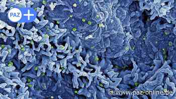 Affenpocken: Erster Fall im Kreis Peine aufgetreten - Peiner Allgemeine Zeitung - PAZ-online.de