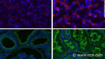 Cell function restored in pigs after death, scientists say